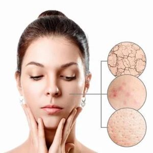 Mesotherapy Skin Treatment in Trivandrum