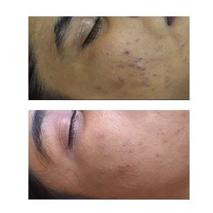 Best Skin Care Clinic in Trivandrum