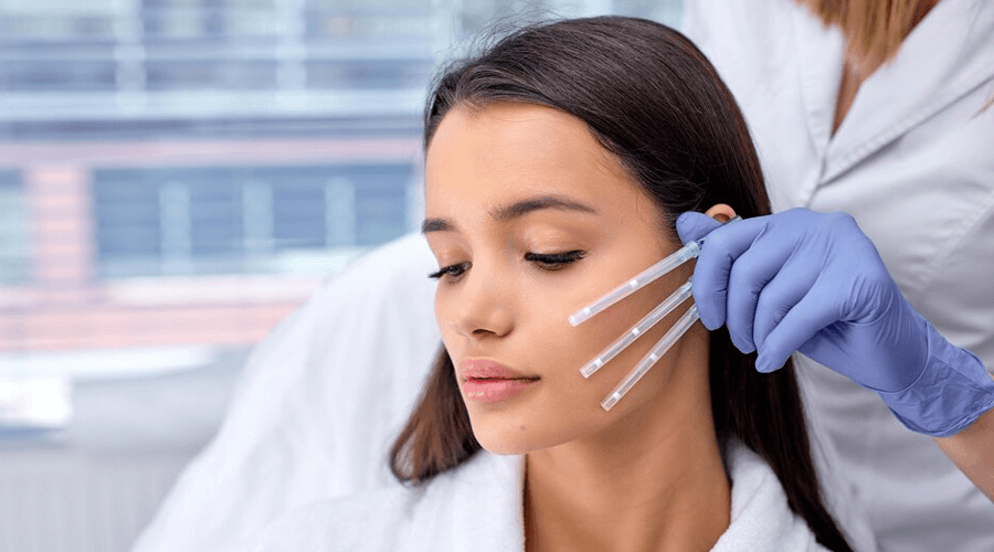 Thread Lift Treatment in Trivandrum