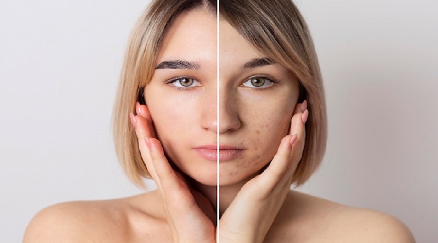 5 Surprising Habits That May Be Hurting Your Skin